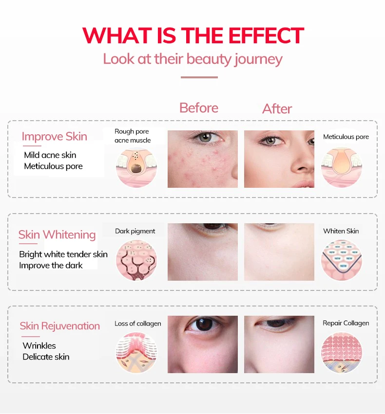 Фабрика BT1000 660nm 850nm Красный Инфракрасный полный корпус светодиодной терапии 1000W красный свет терапии панель