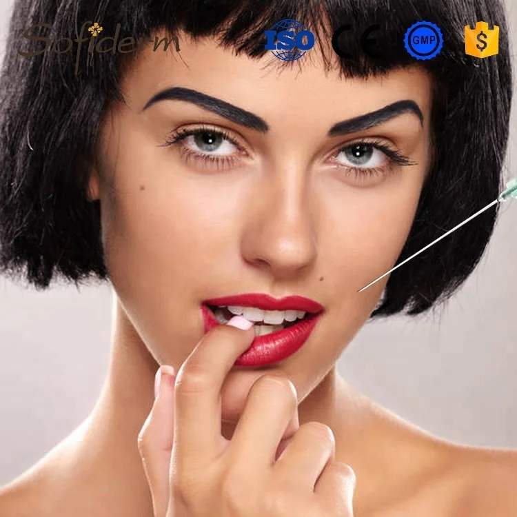 Sofiderm cross linked hyaluronic acid gel filler for lips enhancement