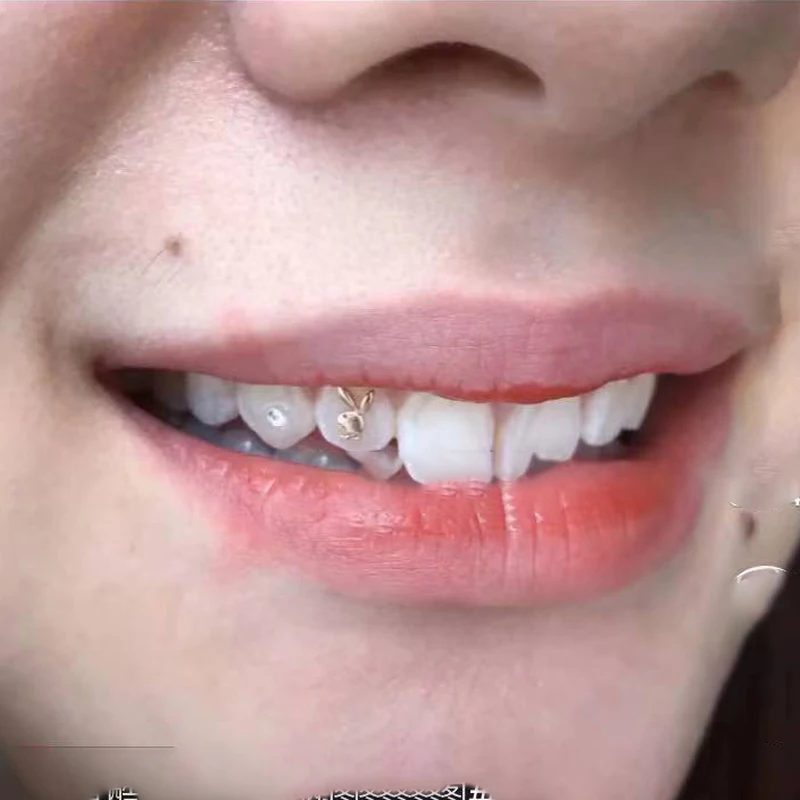 Custom dental jewelry teeth gem etching real solid k gold tooth gems