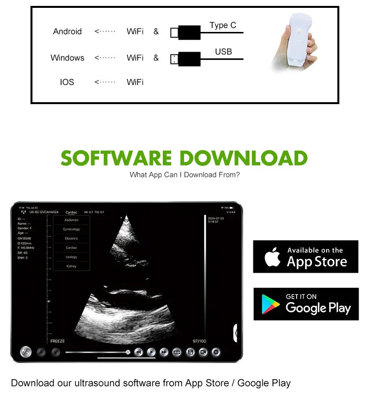 MT MEDICAL Portable Ultrasound Scanner Doppler Micro Convex USB Wifi Wireless Probe Ultrasound Probes