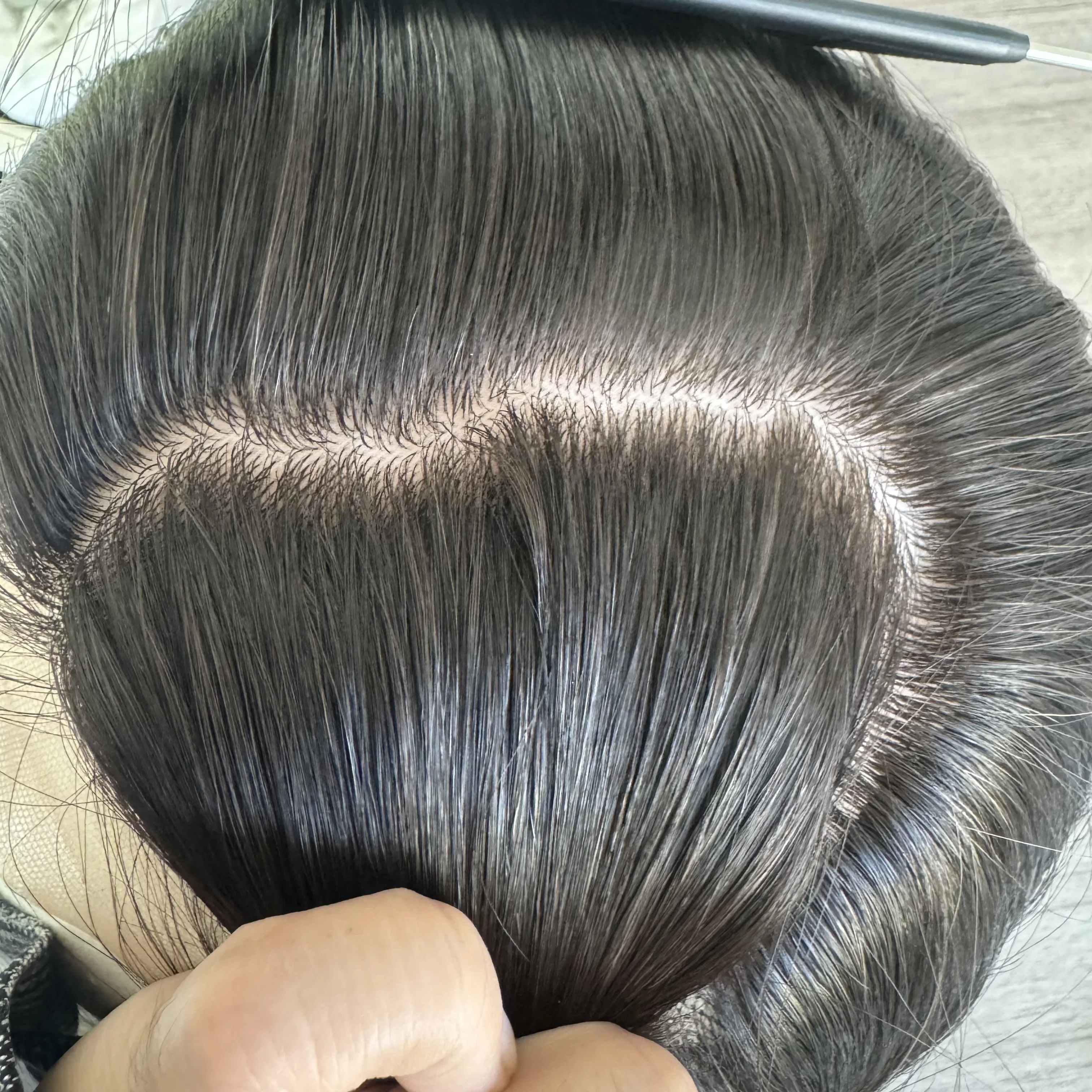 Glueless medical wig add silicone human hair wig cuticle aligned virgin hair wig