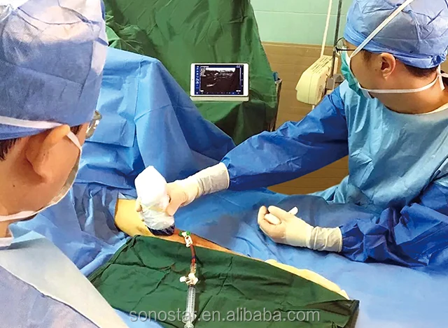 PICC / CVC Use Wireless Ultrasound Scanner Needle Guide for Vein Puncture in Guangzhou