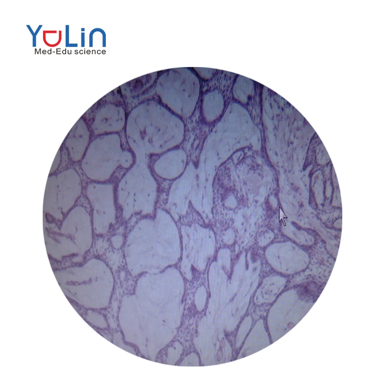 50 slides of medical science human teeth oral pathology prepared for university standards
