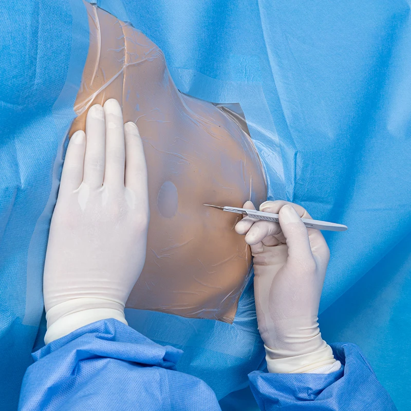 Laparoscopy pack Surgical Drape Disposable 35gSMS Or 45gSMS  CE Approved Single Operation