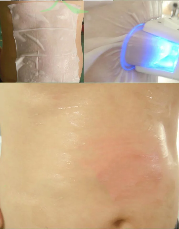 Cryo Machine Skin Protect Freezefats 27*30cm 34*42cm Anti Freeze Membrane