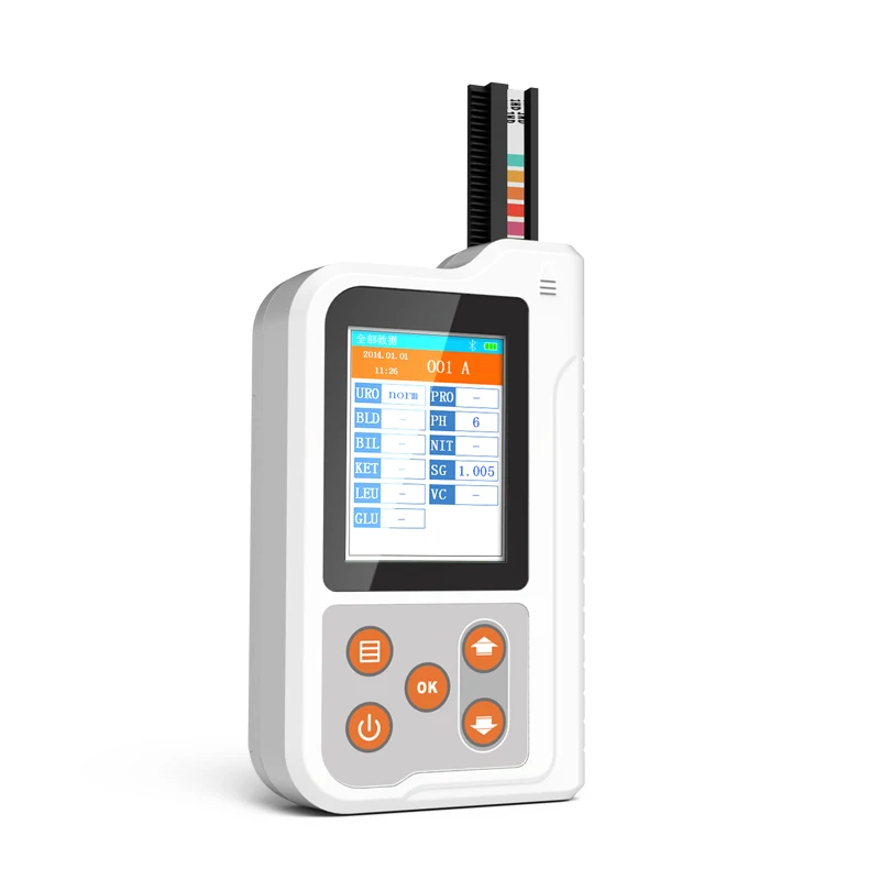 Hospital  Portable immunoassay blood analyzer urine test analyzer fully automated urine analyzer