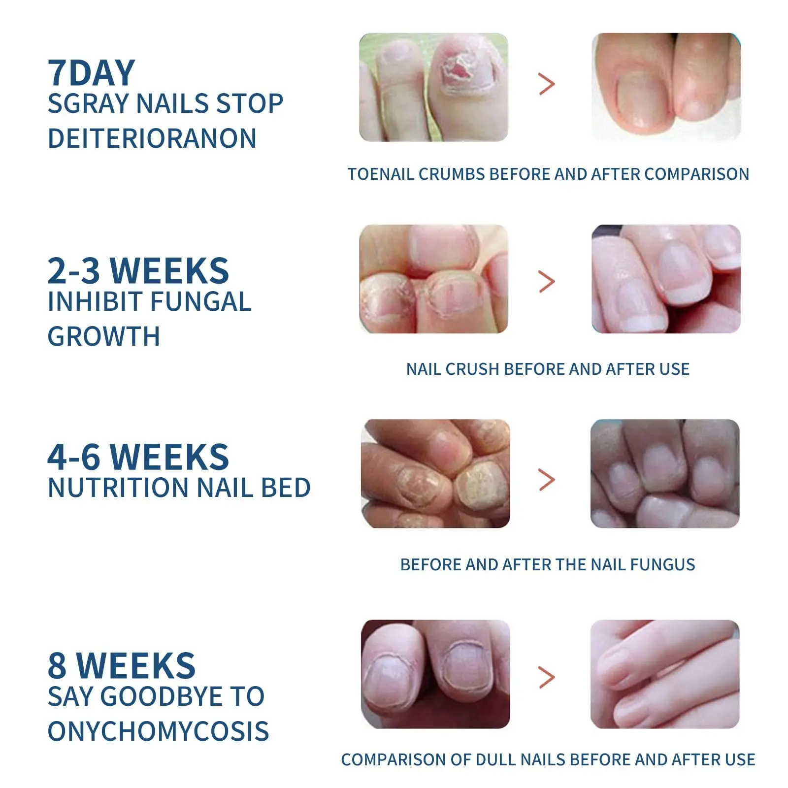 32Pcs 24-Hour Toenail Fungal Treatment Nighttime Renewal Fungal Nail Patches