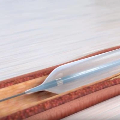 Balloon Dilatation Catheters Angioplasty Stent Balloon Inflator PTCA Semi-Compliant Ballon Cardiac Catheter Manufacturer