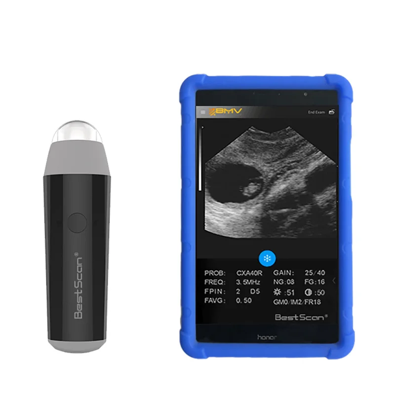BestScan S3 portable pocket wireless bluetooth ultrasound probe echographe equipment for veterinary vet medical