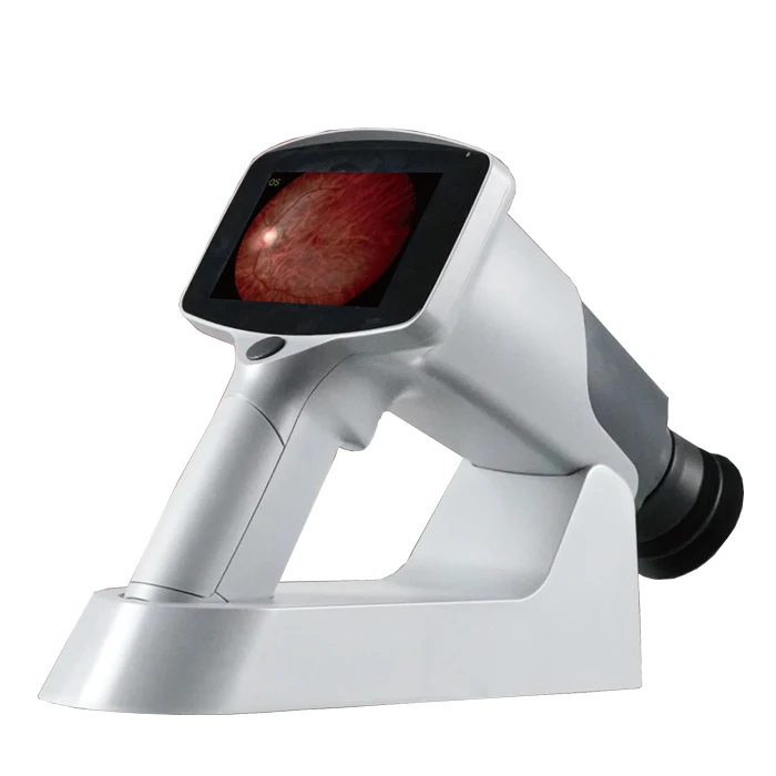 HFC-161 Китай офтальмологические портативный ручной сетчатки глаз фундус-камера