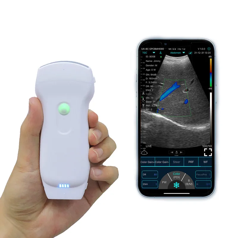 Pet Hospital PW Device 128 Elements Convex Linear Phased Probe Transducer Doppler Digital Portable Scanner Probe USG Wireless