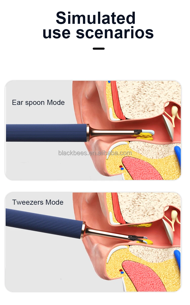 
Bebird Note3 Smart ear cleaning rod earwax removal tweezers kit with 10 mega pixels video camera 