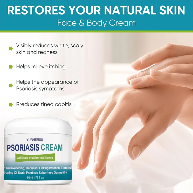 High Quality Natural Skin Care Treatment Psoriasis Eczema Herbal Cream