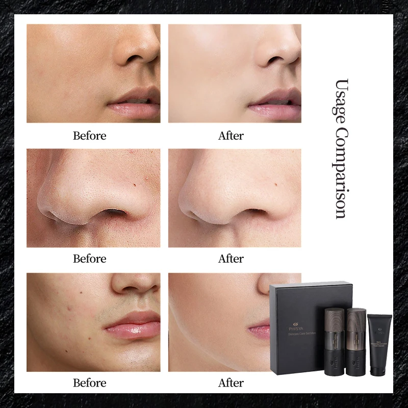 Частная торговая марка уход за кожей профессиональный Отбеливание лица набор для ухода мужчин