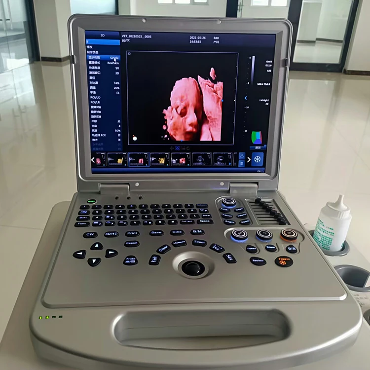 4D 5D Medical ultrasound instruments laptop for clinic hospital portable color doppler ultrasonic ecografo portatil