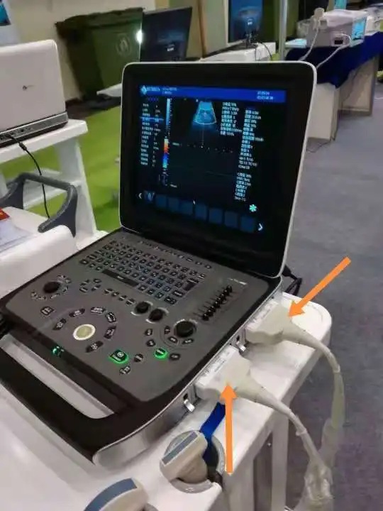 medical ultrasound instruments RUIHUA DU8-M1 model with two probe connectors Laptop Doppler Ultrasound  Echo Machine