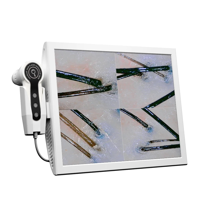 BodanBeauty Personal Care Skin Test Scanner Skin Hair Scalp Detector