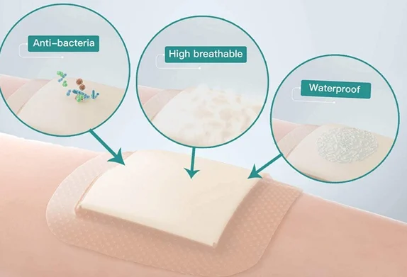 OEM Various Sizes Silicone Foam Dressing Wound Dressing Wholesale Silicone Foam Dressing Cure and Nursing Contact Layer