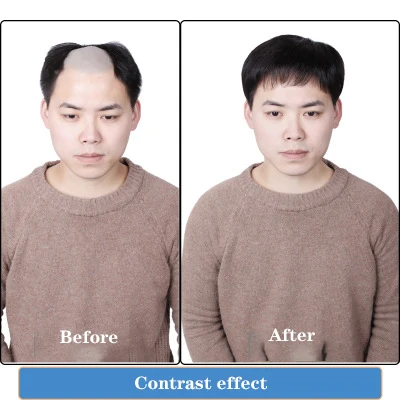 
Man gospel Lace net woven 100% real people hair patch hair head flip toupee Hide the white hair hide the bald head 