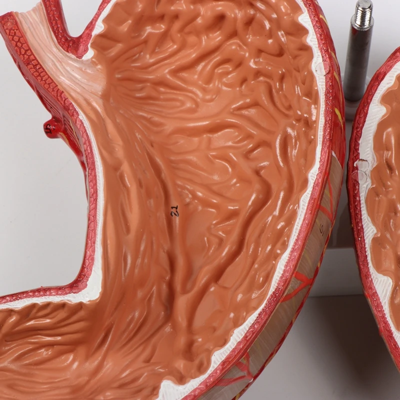 Medical Science Human Digestive System Pathological Stomach Anatomy Model For Education
