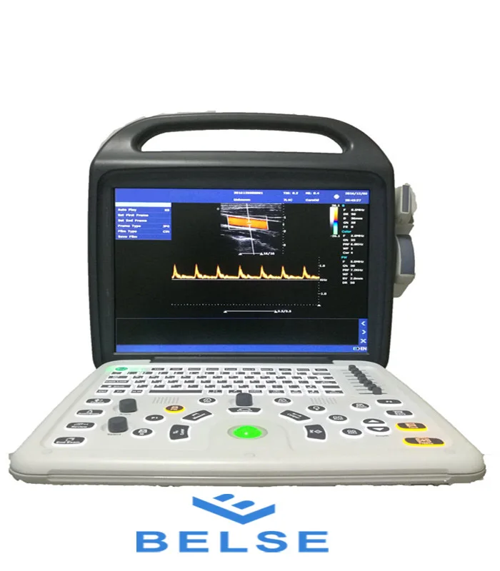 Medical ultrasonic instruments for hospital ultrasound Doppler and gynecological 3D color pregnancy ultrasonic machine