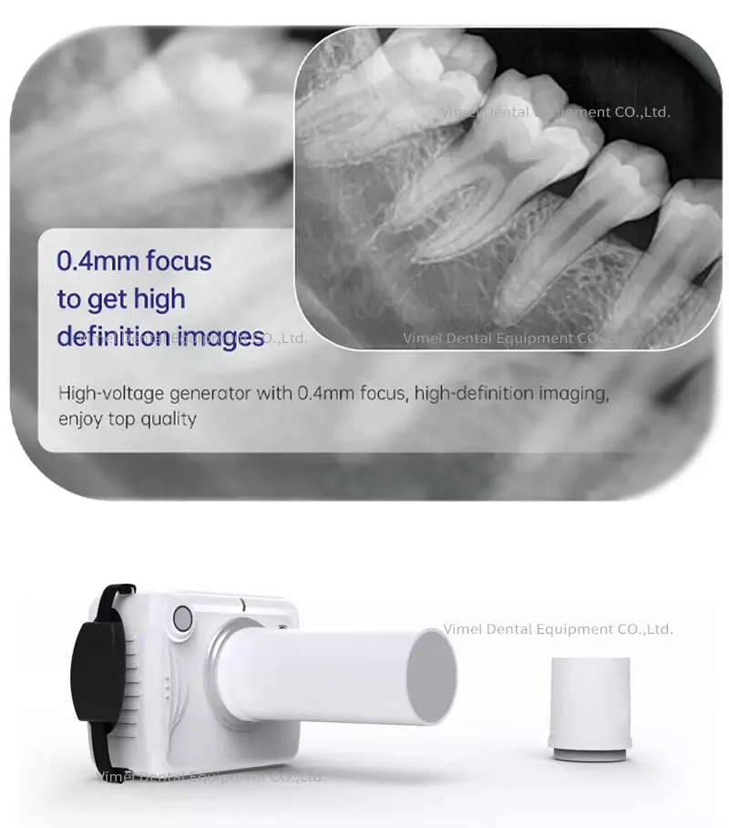 Original High Frequency Refine X05R Dental X-Ray Camera Portable X Ray Unit