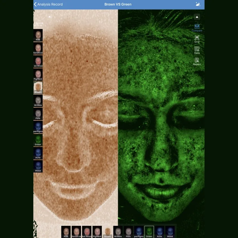 China Professional CE Certified Skin Analyzer Machine Manufactured by Meicet