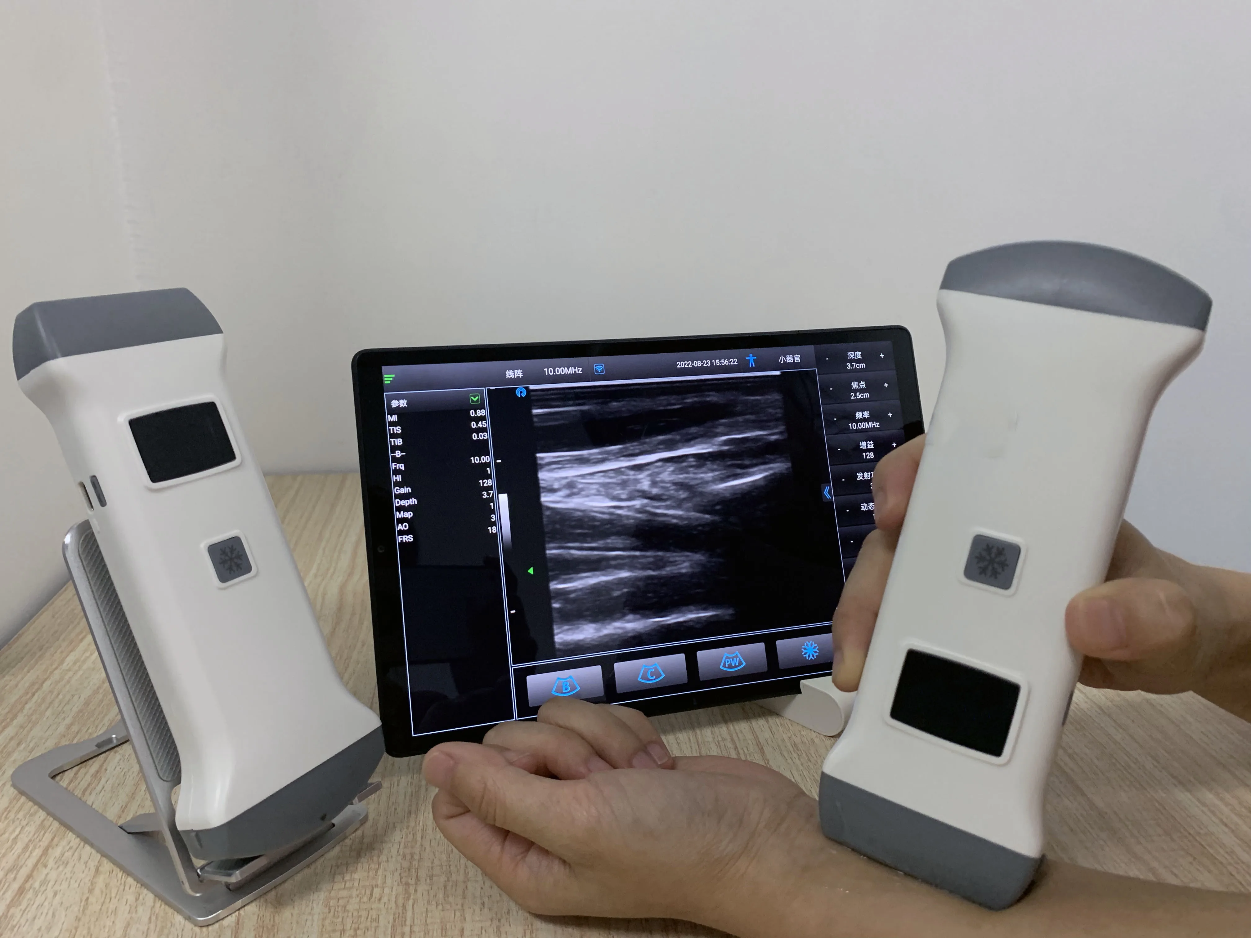 High Definition Laptop Hot-selling Ultrasound Portable Color Doppler System With Portability for