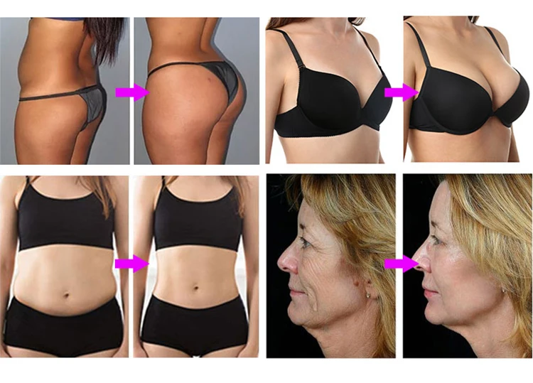 180ml XL big cups enhancement mechanical pump buttock lifting cupping breast enlargement butt lift vacuum machine