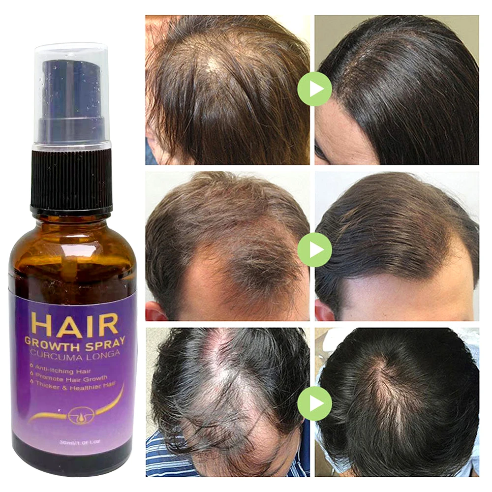 New Ginger Hair Care Growth Serum Hair Loss Treatment Spray 7 Days Effective Germinal Hair Growth Essential Oil