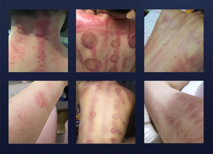 6 in 1 cavitation machine 80k laser rf fat lipo cavitation slimming machine Ems pads Lipocavitation 80 k