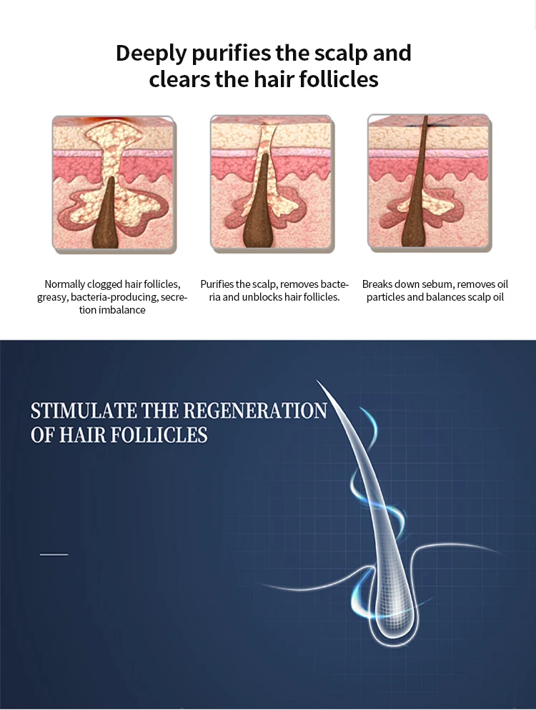 New Arrival 12 Inches 5 in 1 High Frequency Hair Scalp Massage Machine Care Device Analysis Growth Follicle Salon Amy Beauty