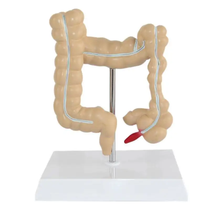 Advanced Medical Supplies Human Teaching Large Intestine Anatomy Model For School and hospital