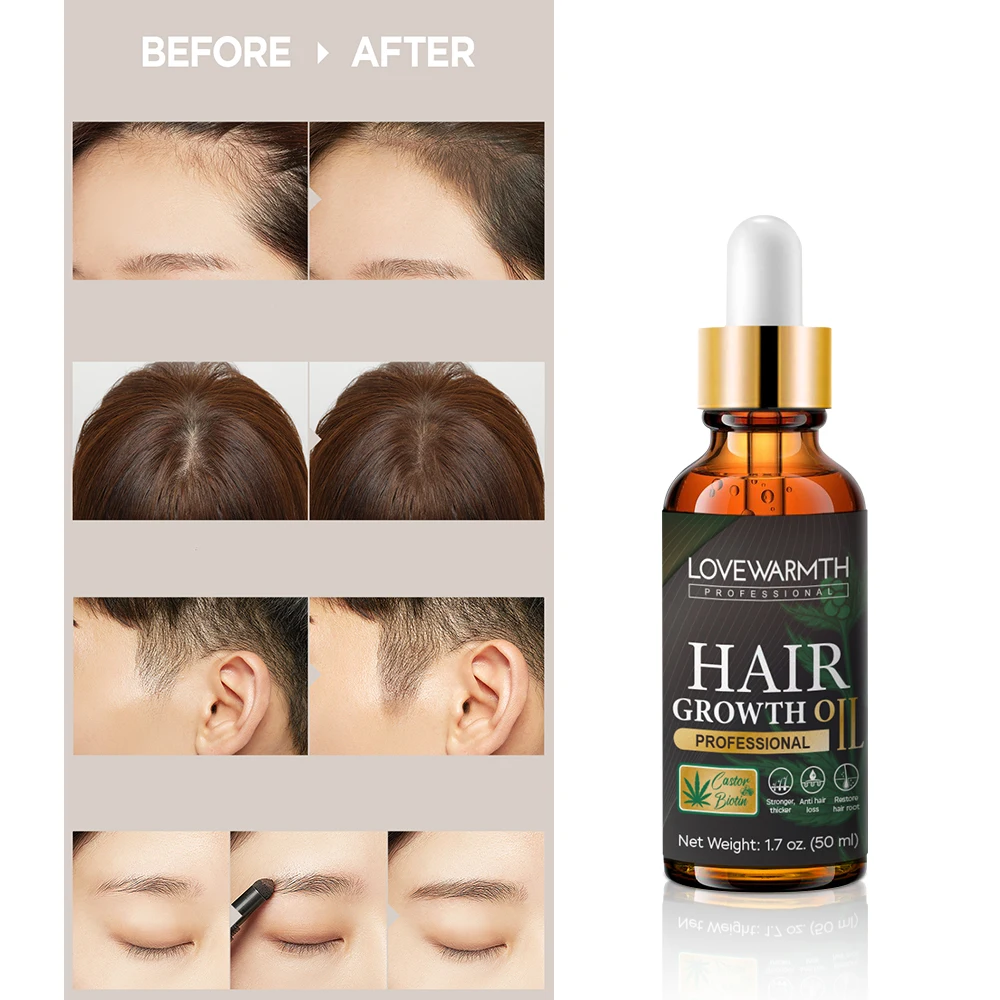 Best Regrowth Hair Oil Private Label Vegan Organic Nourishing Hair Care Product Fast Hair Growth Oil