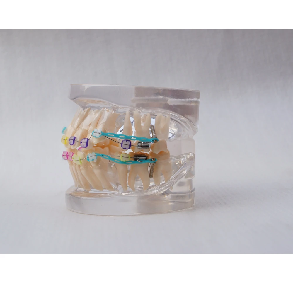 Dental Ortho Ceramic Bracket Study Model 24 Teeth
