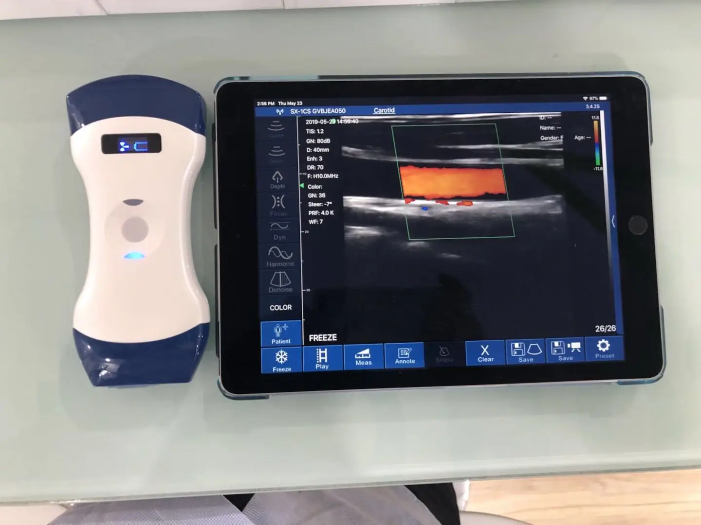 Цветной Допплер Беспроводной ультразвуковой сканер электрические пластиковые Ce HF он-лайн служба технической поддержки 2 лет 128 элементов 3,5/5 МГц Класс II