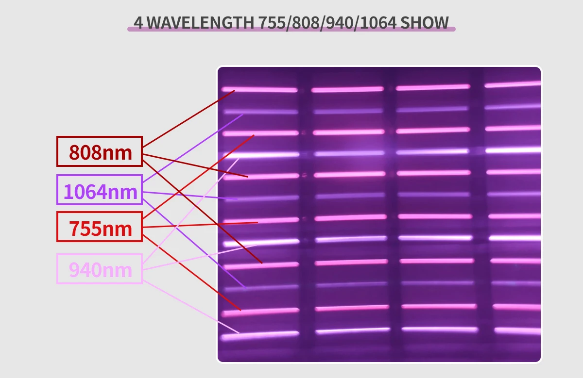 Лазерная эпиляция машина 1600W 808Nm диод лазерная для удаления волос с помощью лазера женщин