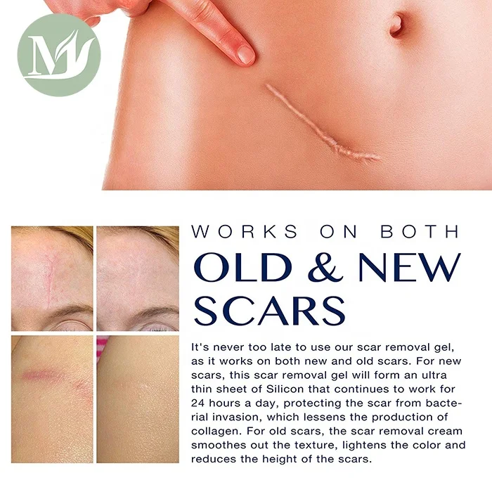 Professional Silicon Scar Remover Cream Gel for Effective for both Old and New Scars