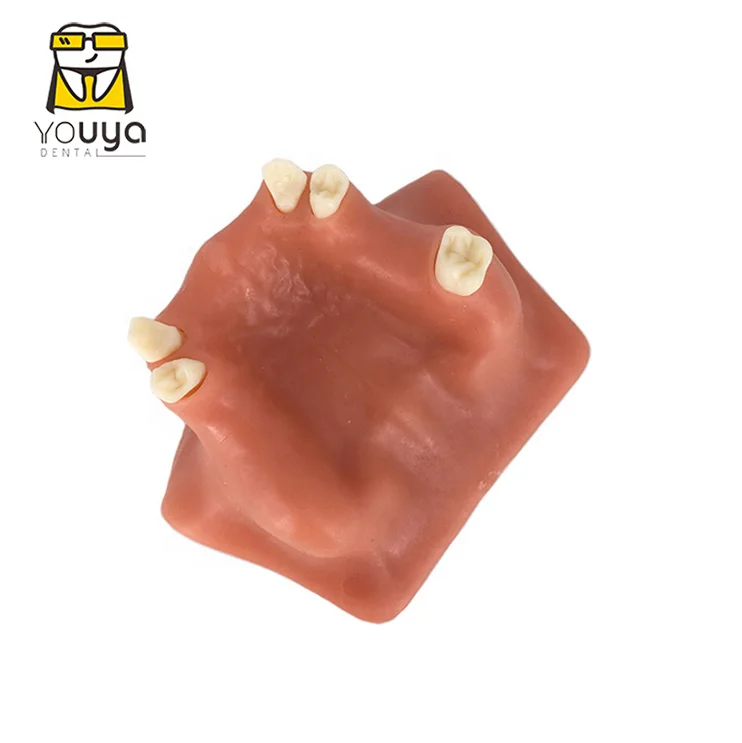Dental sinus lift training model With soft gum,dental training model ,dental implant model