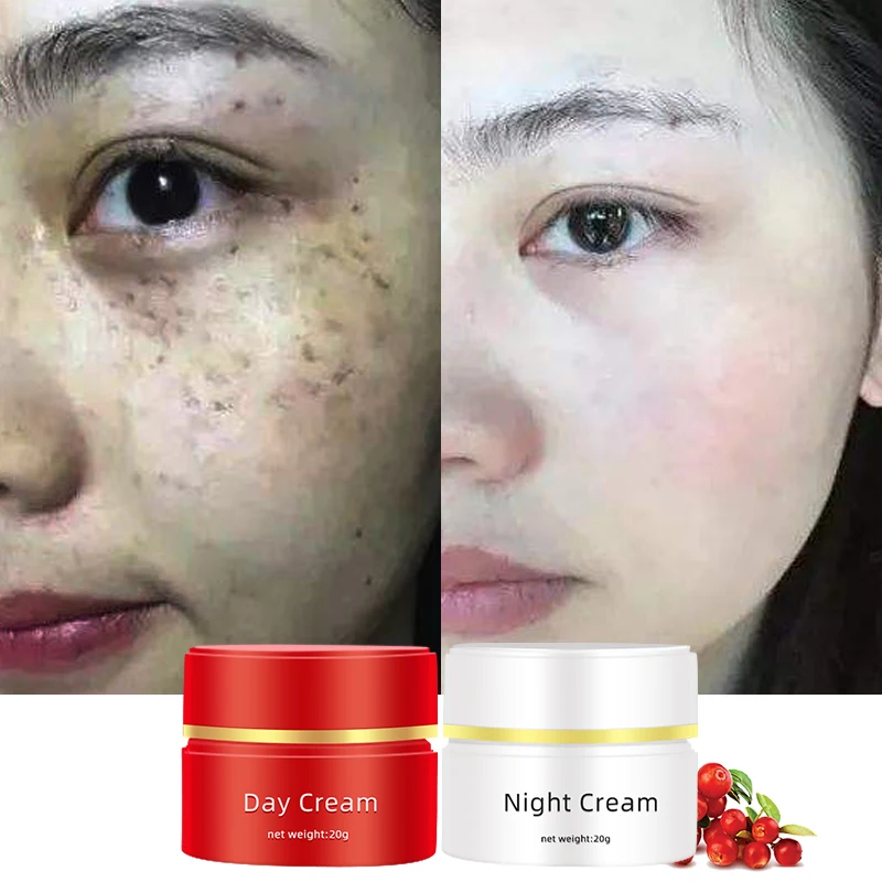 Effect Strong Removal Melasma Whitening Cream Freckle Spe Freckle Enhancing Reduction Sun Removing Cream Fade Dark Spot