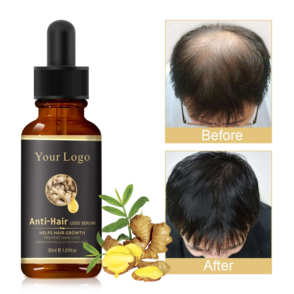 Custom Logo Natural Ginger Essential oil Men Hair Regrowth Treatment Scalp Care Oils Hair Growth Serum