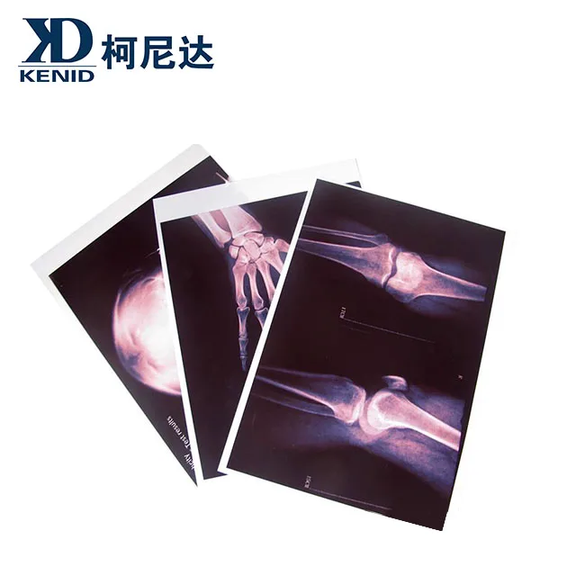 carestream dryview dvb laser imaging film x ray kodak laser x-ray kodak medical film