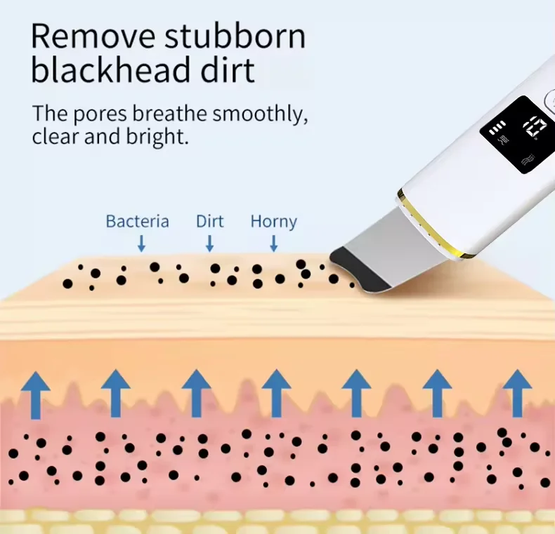 Customized Logo Ultrasonic Skin Scrubber Facial Scrubber Blackhead Remover Pore Cleaner Skin Spatula Skin Scraper with 4 Modes