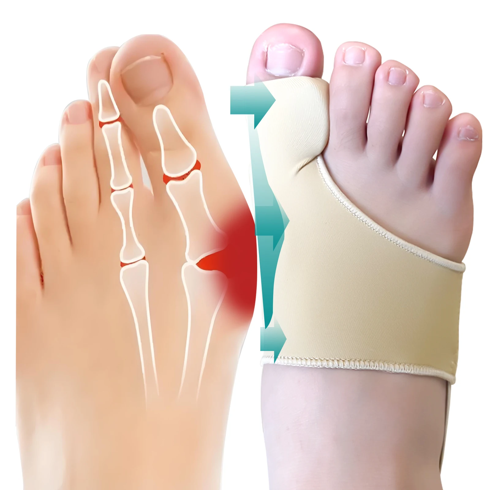 Wholesale Foot Care Products Orthosis Protector Toe Support  Bunion Pain Joanete Juantes  Bunion Corrector Hallux Valgus