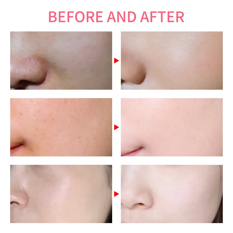 Beauty Personal Care 24k Gold Essence Organic SkinCare Hyaluronic Serum Skin Care Anti Aging Collagen Vegan Cosmetics Face Serum