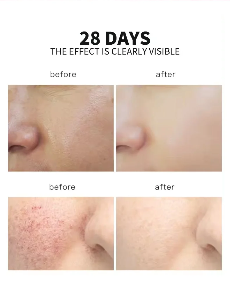 5 IN 1 Skin Care Brightening Vitamin C Niacinamide Elasticity Instant Lift Anti Wrinkle Smooth Collagen Face Serum