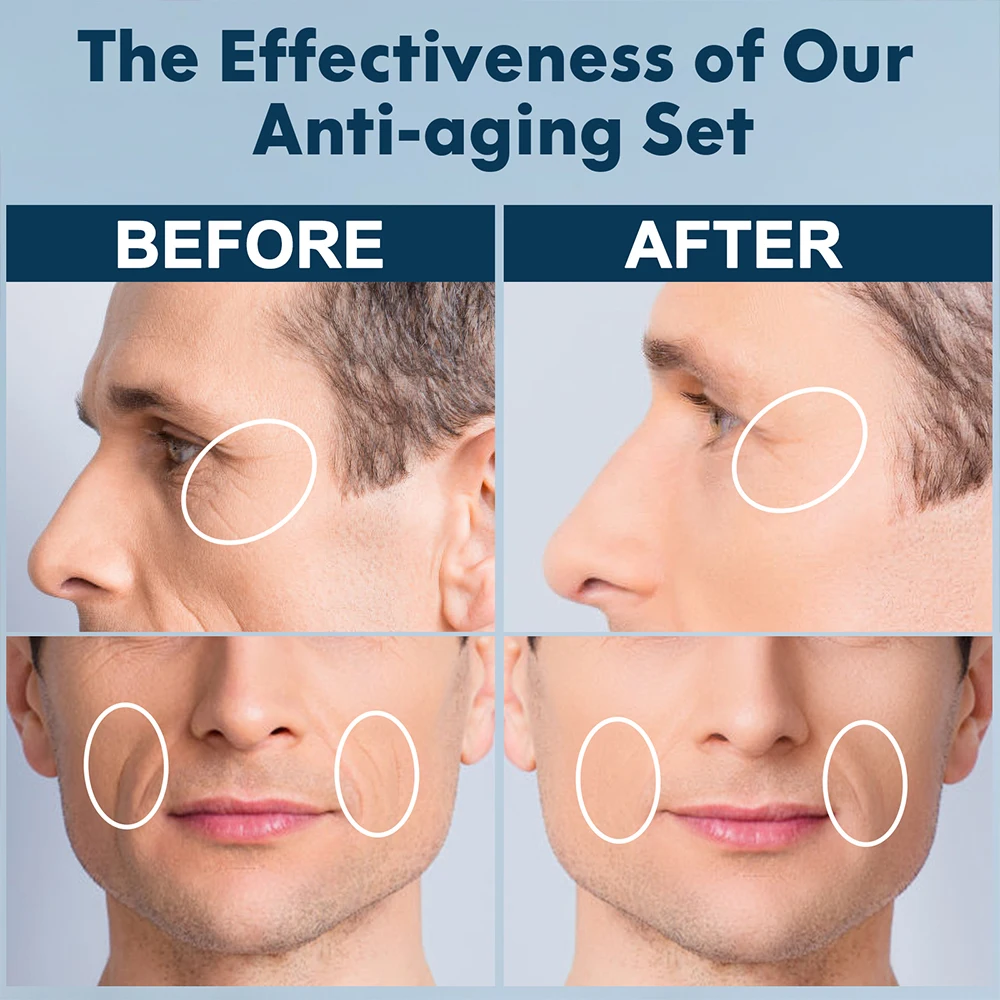 OEM Customize Mens Face Beauty Anti Acne Hyaluronic Acid Whitening Brightening Moisturizing Repair Men Skin Care Set