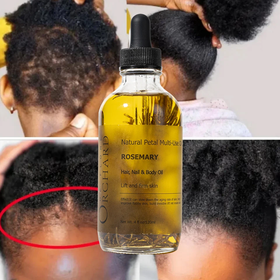 120ml Wholesale Strengthening Nourish Hair Scalp Care Organic Pure Rosemary Oil For Hair Growth