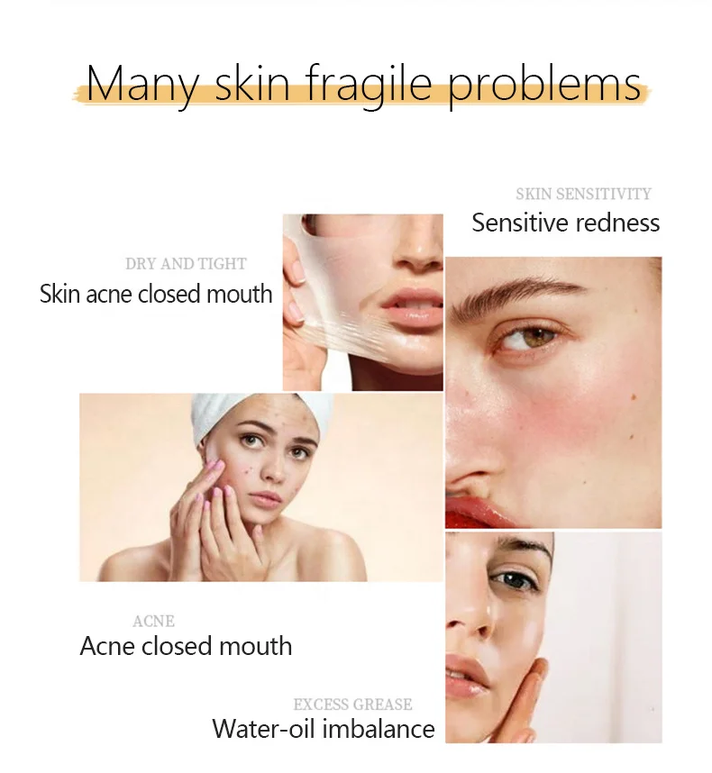 Factory Custom Natural Organic Kaolin Face Skin Care Mud Mask Deep Cleansing Oil Control Anti Acne Clay Mask