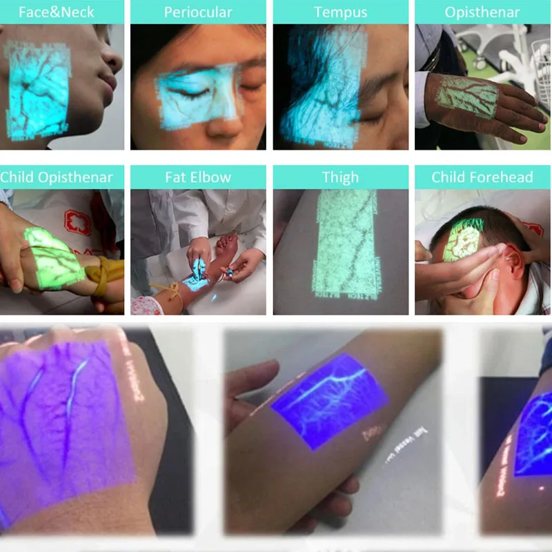 
Hospital Doctor Nurse Use Injection Medical Projection Vein Finder Detector 